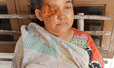 Wanita Penderita Kanker Mata Dapat Respon Gubernur Riau