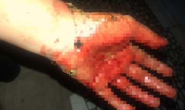 Polda Limpahkan Laporan Kasus KDRT Warga Jati Mulyo ke Polres Lampung Selatan