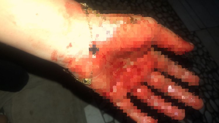 Polda Limpahkan Laporan Kasus KDRT Warga Jati Mulyo ke Polres Lampung Selatan