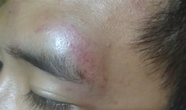 Hanya Karena Lapor Siswa Bolos, Seorang Pelajar di Way Kanan Babak Belur Dianiaya